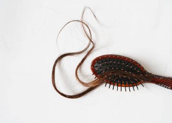 Alopecia, problema di perdita dei capelli