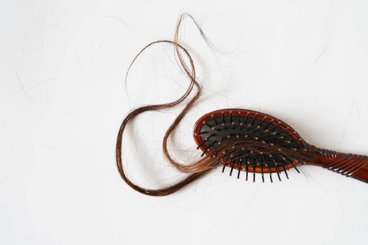 Alopecia, problema di perdita dei capelli