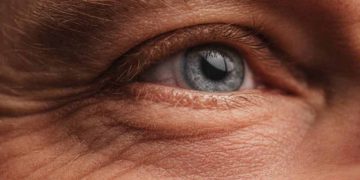 Patologia oculare tiroidea