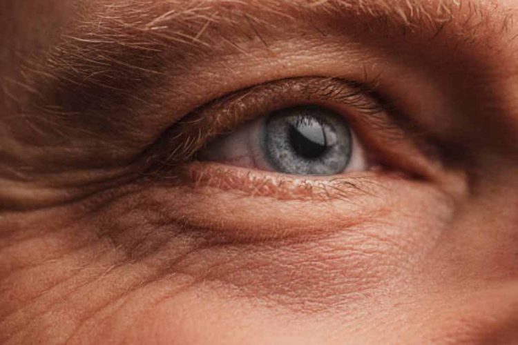 Patologia oculare tiroidea