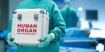 Prelievo multiorgano