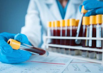 Test del sangue per diagnosi precoce Parkinson