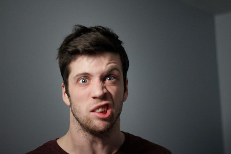 Un uomo con una paralisi del volto