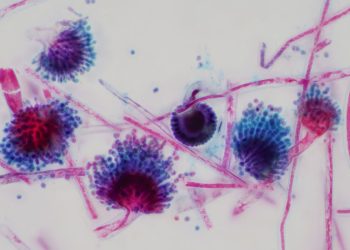 Un fungo capace di ‘divorarti dall’interno’ potrebbe diffondersi con il riscaldamento globale