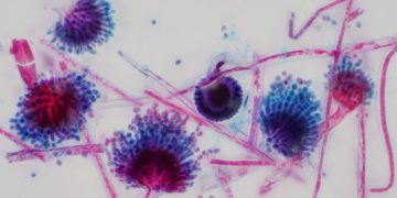 Un fungo capace di ‘divorarti dall’interno’ potrebbe diffondersi con il riscaldamento globale