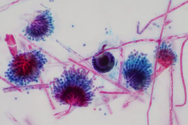Aspergillus - alanews.it