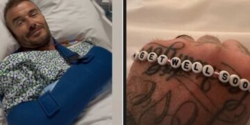 David Beckham infortunio