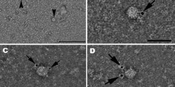 Il virus dell'epatite D visto al microscopio