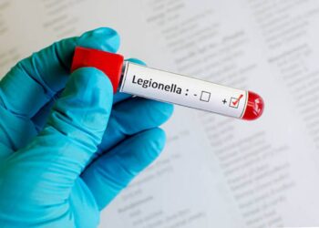 Legionella