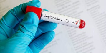Legionella