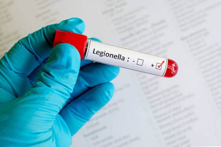 Legionella