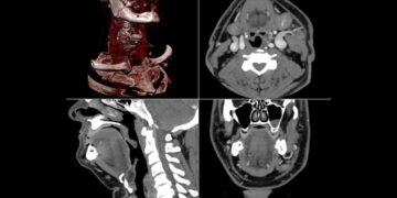 Esempi di immagini solitamente fornite da una TAC