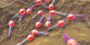 Il batterio che causa l'intossicazione da botulino