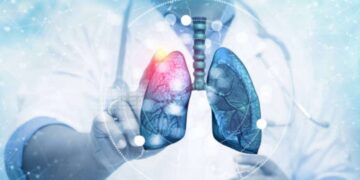 Mutazione tumori ai polmoni