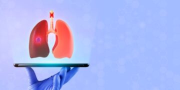 Nuova cura dal mare per il tumore ai polmoni