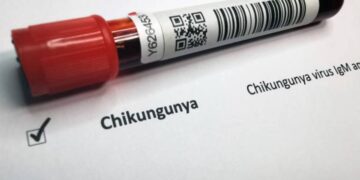 Un caso di chikungunya in Italia