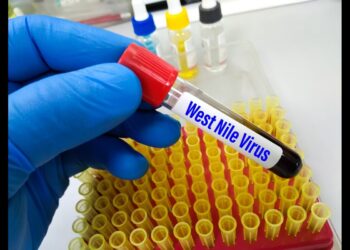 Virus West Nile
