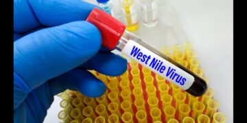 Virus West Nile