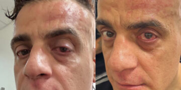 Lo YouTuber Simone Cicalone aggredito alla stazione di Napoli durante un tentativo di riprese