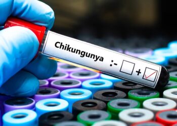 virus-Chikungunya@alanews.it