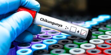 virus-Chikungunya@alanews.it