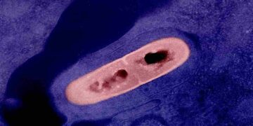 Il batterio che causa la listeriosi