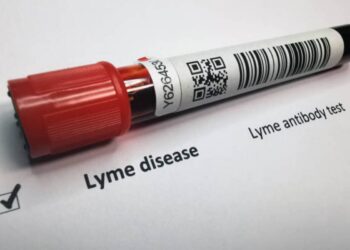 Malattia di Lyme