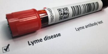Malattia di Lyme