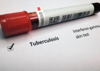 Segnalati 4 casi di tubercolosi nel trapanese