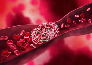 Soperto il meccanismo delle trombosi nel Covid