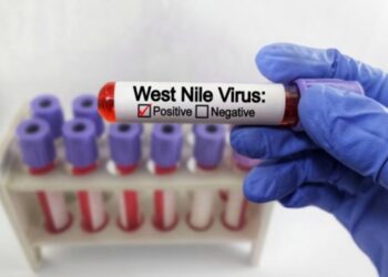 Un caso di West Nile a Messina