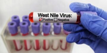 Un caso di West Nile a Messina