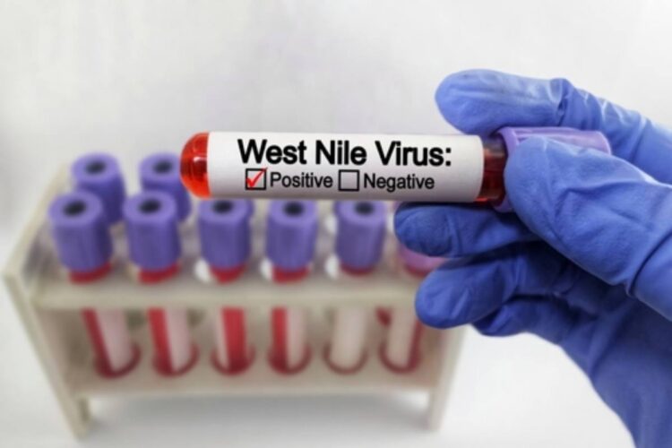 Un caso di West Nile a Messina