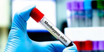 Finita l'emergenza per il vaiolo delle scimmie