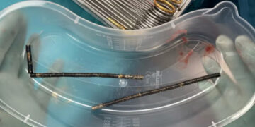 New Zealand, 13enne ingoia 100 magneti di Temu