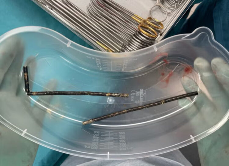 New Zealand, 13enne ingoia 100 magneti di Temu