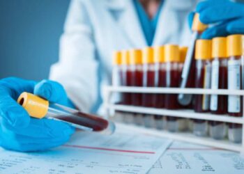 Parkinson, identificate alterazioni nel sangue dei pazienti