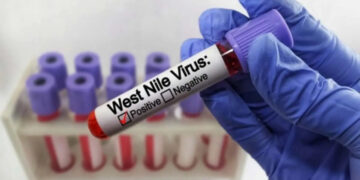 West Nile in Sardegna