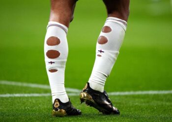I calzettoni bucati dei calciatori: moda da spogliatoio o vero trucco muscolare?
