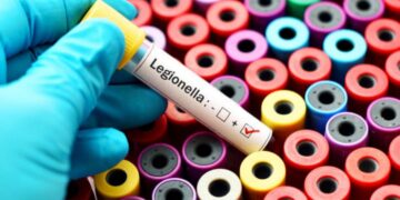 Focolaio di legionella a Milano