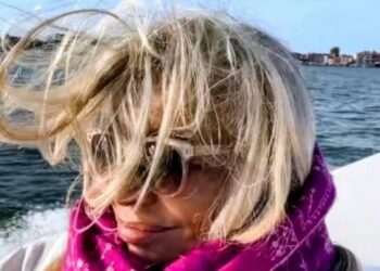 Mara Venier e la maculopatia