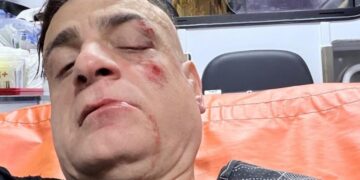 Simone Cicalone aggredito a Roma