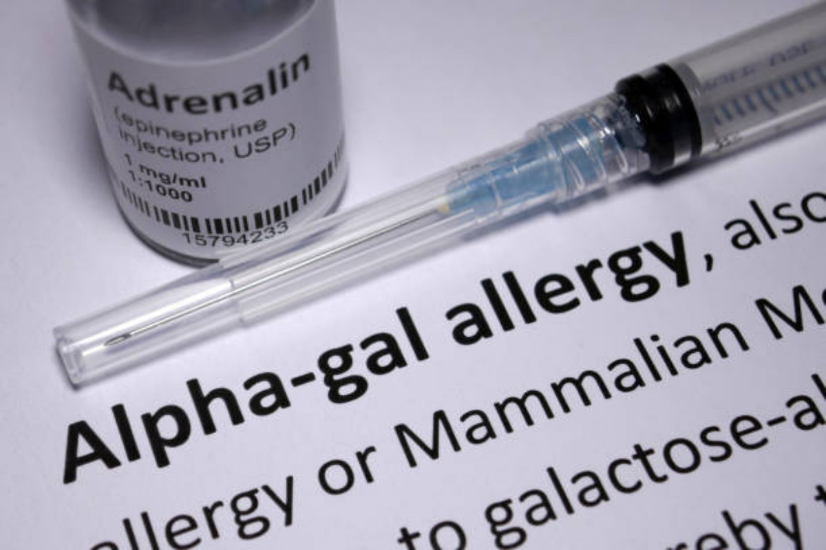 Sindrome alfa-gal: caratteristiche e sintomi