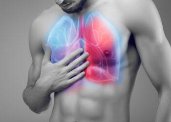 Polmonite interstiziale, il disturbo respiratorio che molti ignorano finché non diventa grave