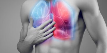 Polmonite interstiziale, il disturbo respiratorio che molti ignorano finché non diventa grave