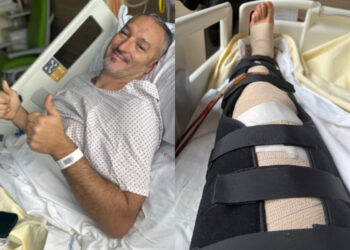 Gianluca Zambrotta dopo l'operazione alle gambe