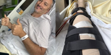 Gianluca Zambrotta dopo l'operazione alle gambe