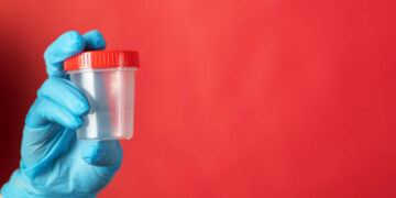 200 bambini sono nati da un donatore a rischio cancro