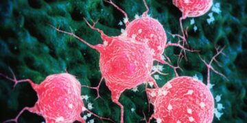 Allergia contro i tumori