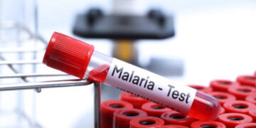 Malaria e resistenza ai farmaci